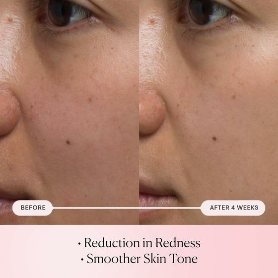 V7H8B0E418004FD1E9984BCA8C4C1070DD1R6617800P3